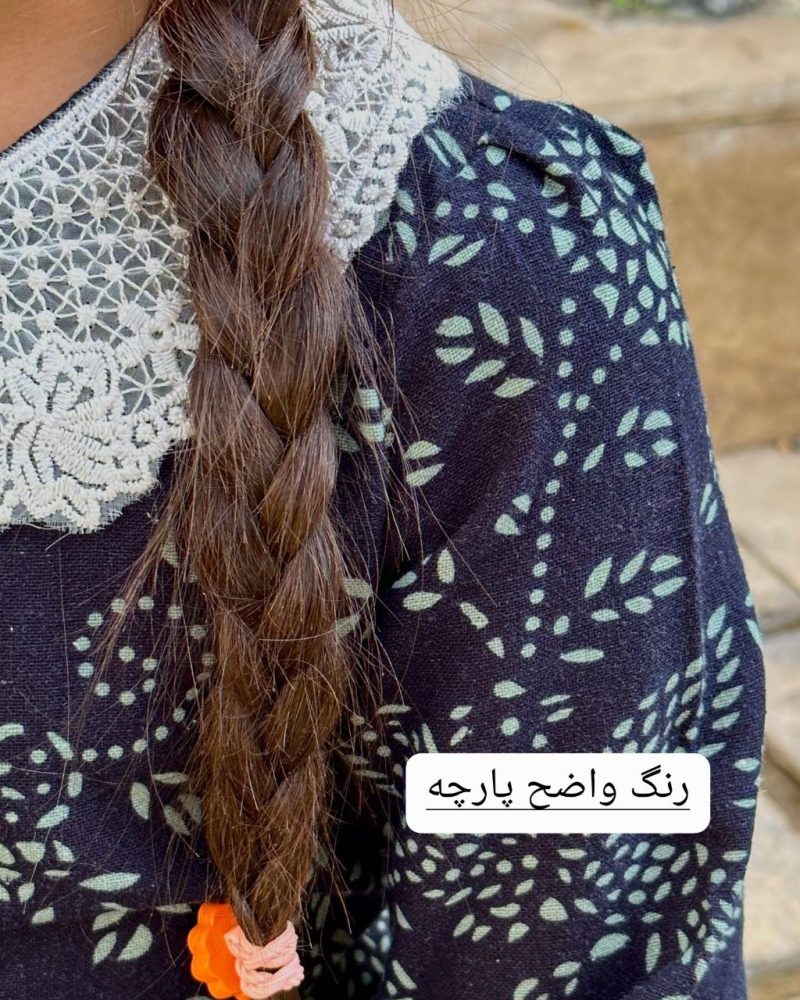 پیراهن لینن نخ دخترانه طرح صنوبر(۱/۵ تا ۷ سال) - Image 3